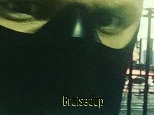 Bruisedup